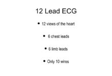 leads on ecg